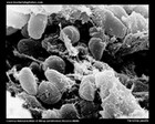 Yersinia pestis micrograph